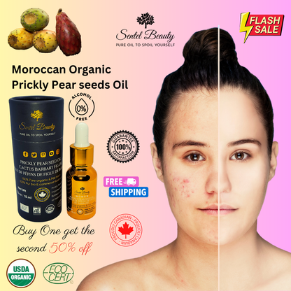 Prickly Pear Oil for Radiant Skin